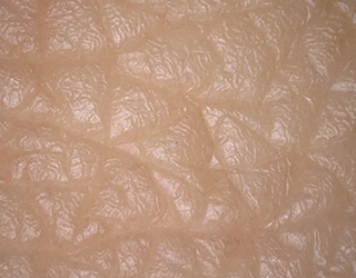 Imagen de la textura de la piel con iluminación múltiple (réplica de la piel)
