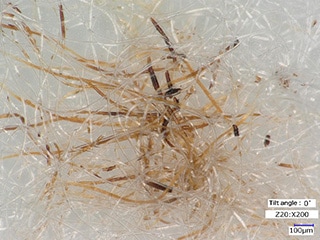 Partícula extraña en un hisopo de algodón (200×)